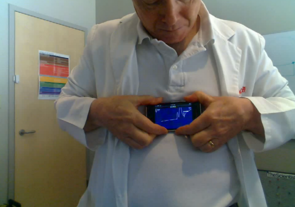 iPhone ECG